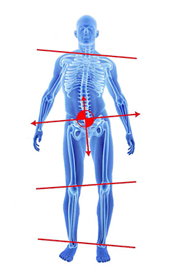 Before image showing skeleton with curved posture