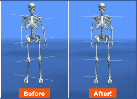 Before and after