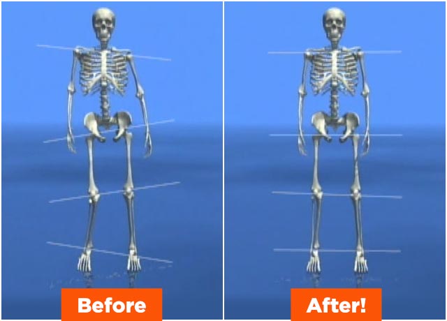 WalkFit® Platinum — Before & After!